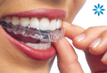 Invisalign Dentist